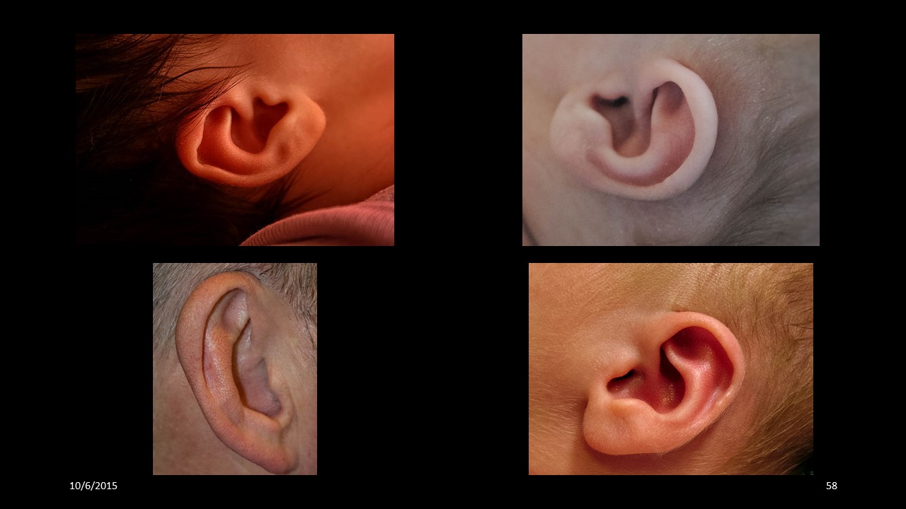 ear
